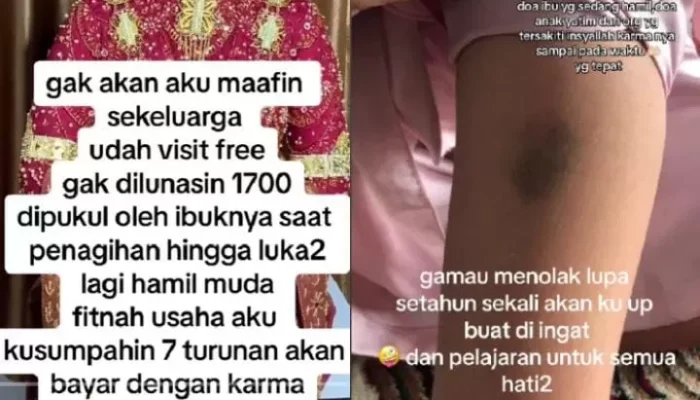 Viral, MUA Curhat Tak Dibayar dan Dipukul oleh Kliennya